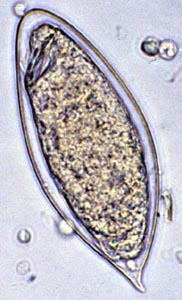 Яйцо шистосомы (Schistosoma haematobium)